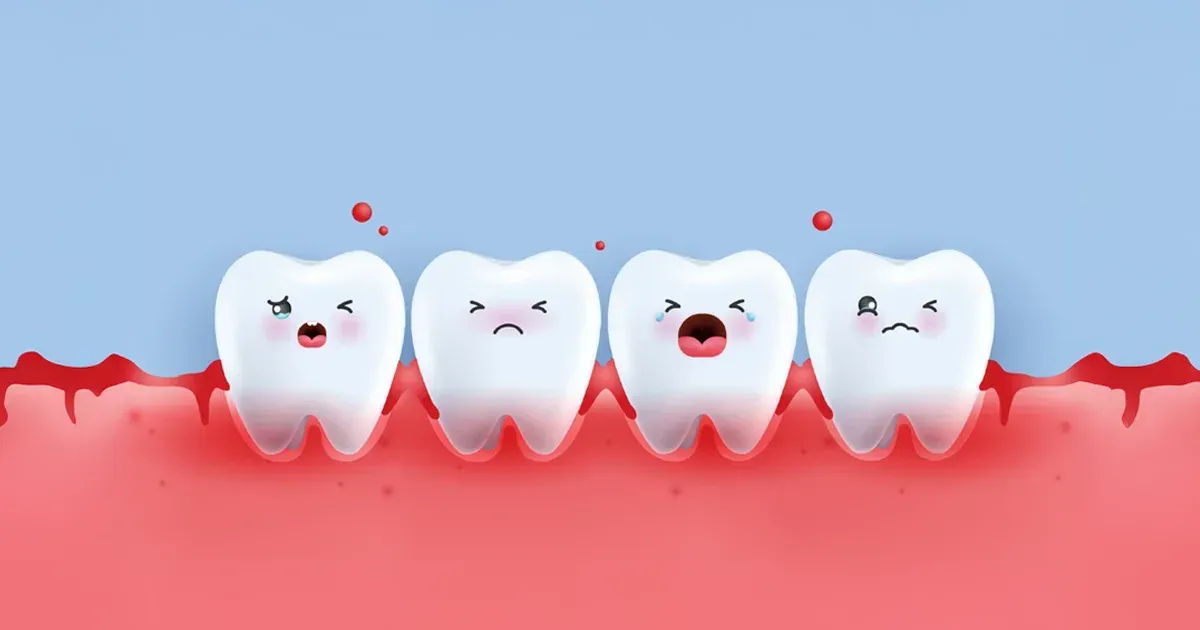 Symptome von Zahnfleischerkrankungen stehen im Zusammenhang mit einem höheren Risiko für mehrere chronische Erkrankungen