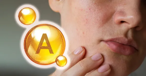 Vitamin A kann helfen, darmkrebs zu verhindern